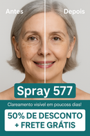 ClareSkin 577 — Spray Removedor de Manchas, Sol, Idade e Melasma! 50% DE DESCONTO + FRETE GRÁTIS!