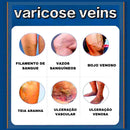 O Creme Poderoso Contra Varizes! Promoção: 50% de Desconto + Frete Grátis!