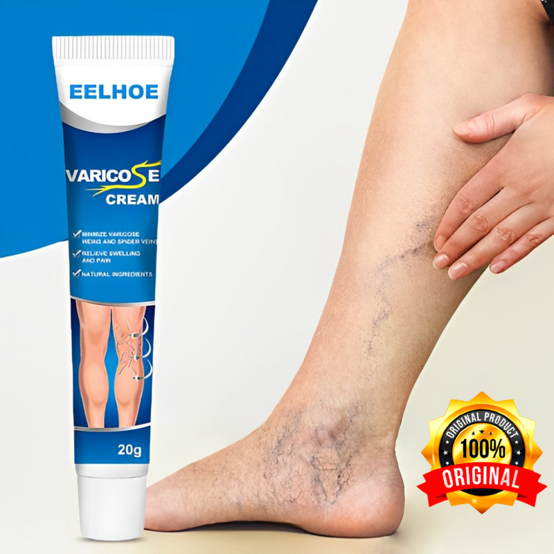 O Creme Poderoso Contra Varizes! Promoção: 50% de Desconto + Frete Grátis!