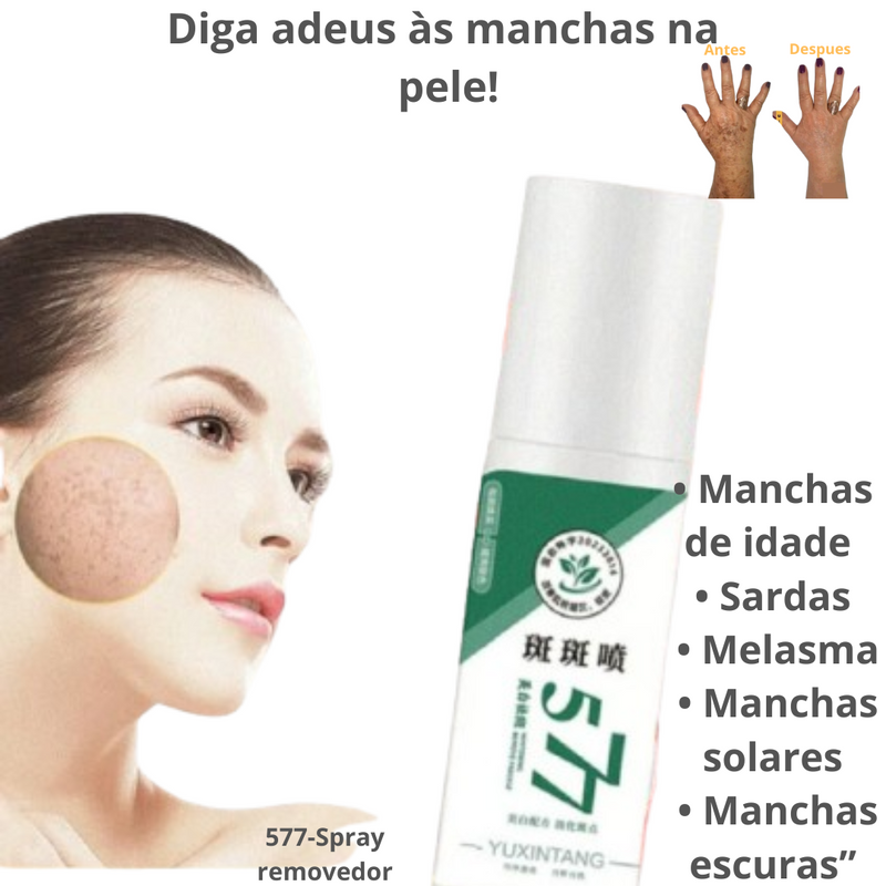 ClareSkin 577 — Spray Removedor de Manchas, Sol, Idade e Melasma! 50% DE DESCONTO + FRETE GRÁTIS!